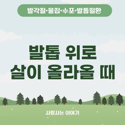 발톱 위로 살이 올라올 때, 내성발톱일까? 원인과 대처법