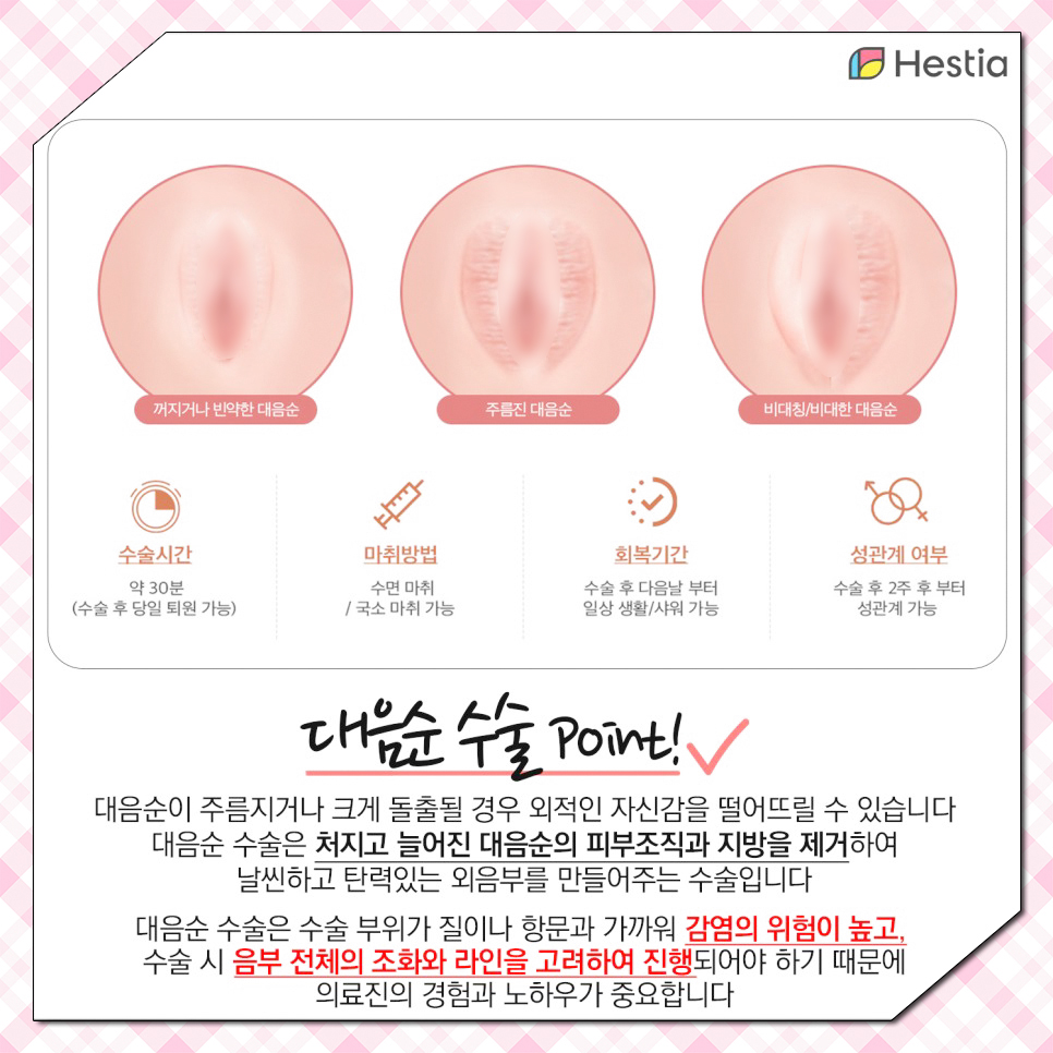 대음순수술