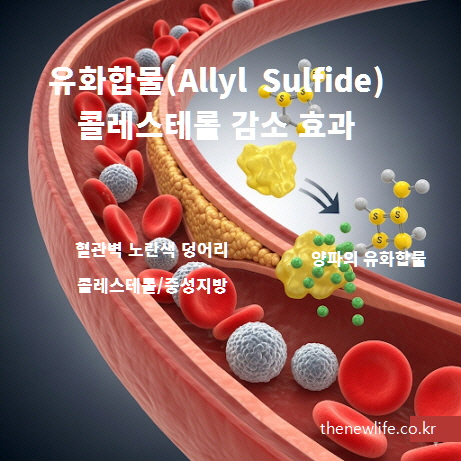 양파 속 유화합물(Allyl Sulfide)이 콜레스테롤과 중성지방 수치를 낮추고 고지혈증 개선에 도움을 주는 원리