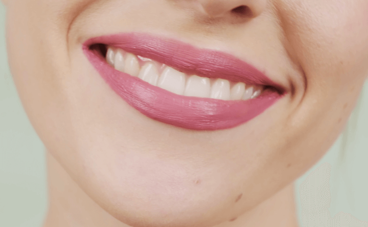 깨끗한-치아-미소