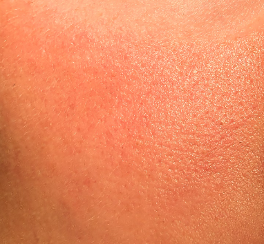 귀리 효능 : 피부건강