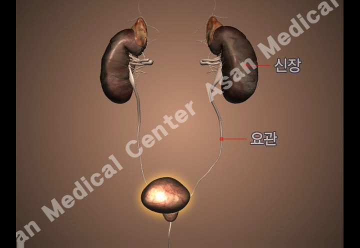 방광염 증상·원인·치료방법, 꼭 알아야 할 건강 상식