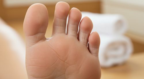 발바닥 굳은살 치료법과 홈케어 가이드