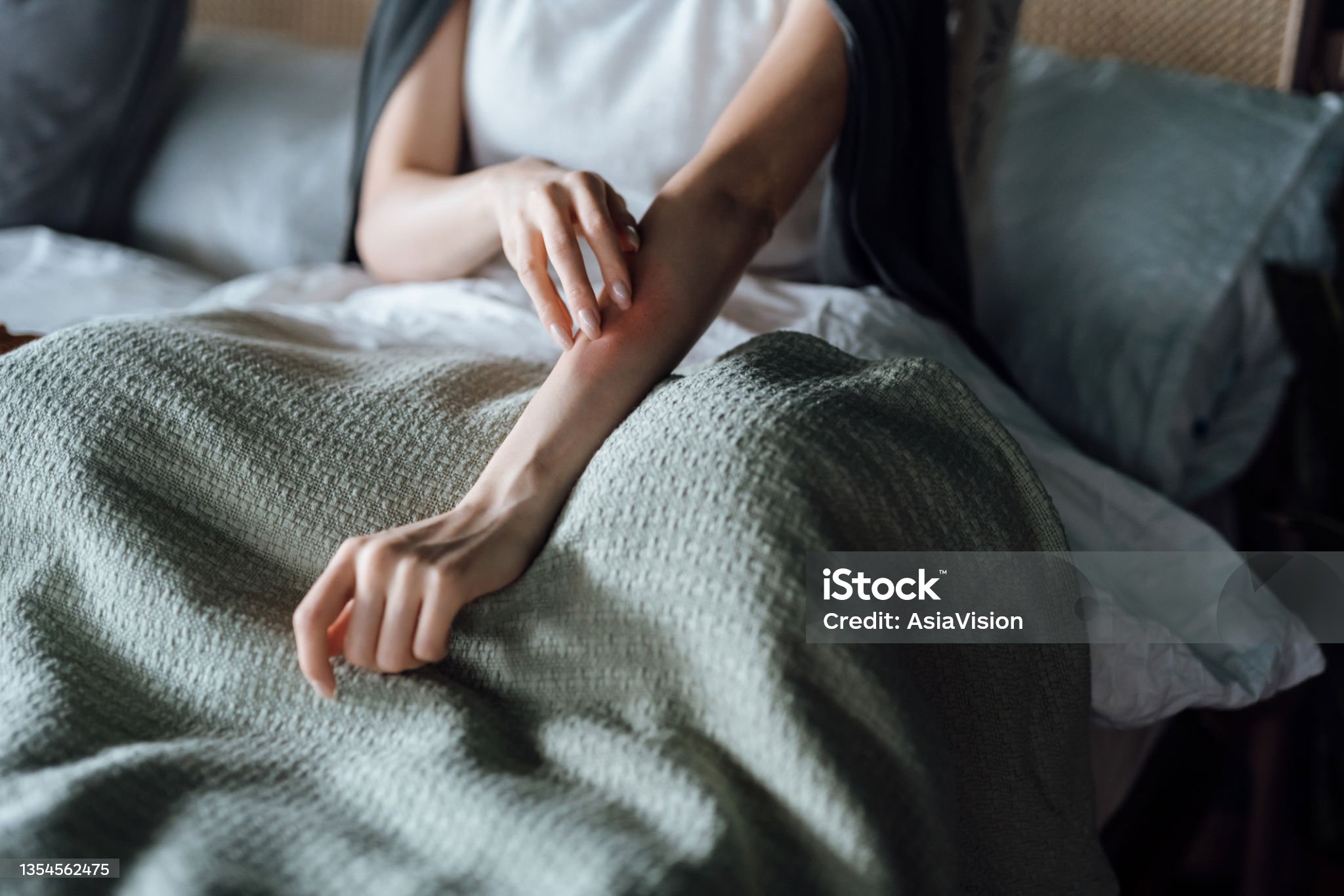 가렵다고해서 막 긁으면 오히려 덧납니다