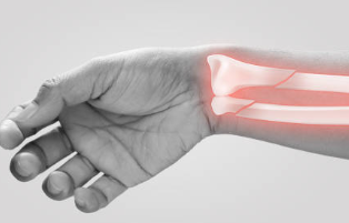 손목 터널 증후군 치료법 증상 수술비용 및 수술법 손목 터널 증후군 운동 수술 후 관리