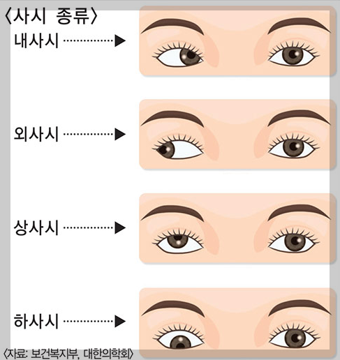 약시와사시