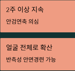 눈꺼풀 떨림현상