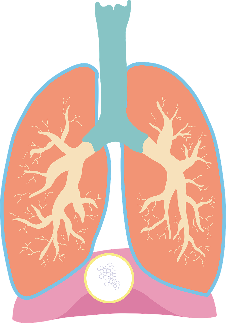천식 폐 이미지