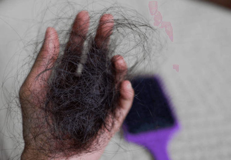 비 맞으면 탈모