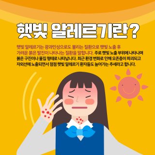 여름철 햇빛 알러지&amp;#44; 예방과 관리 방법 총정리!