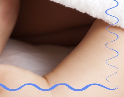 모야모야병 증상