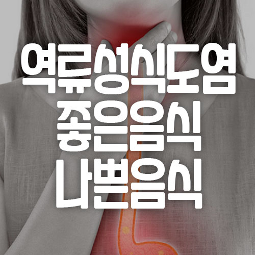 역류성식도염 좋은 음식 나쁜 음식