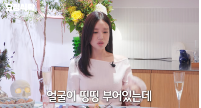 안은진 안면마비 투병 고백
