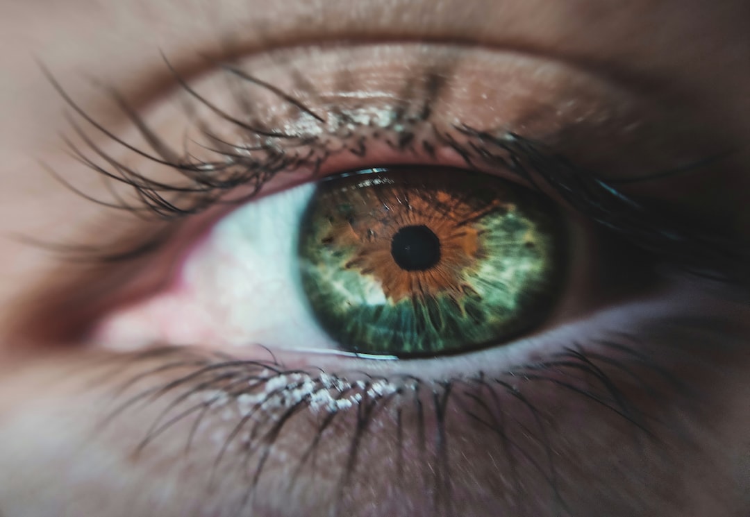 Retina.