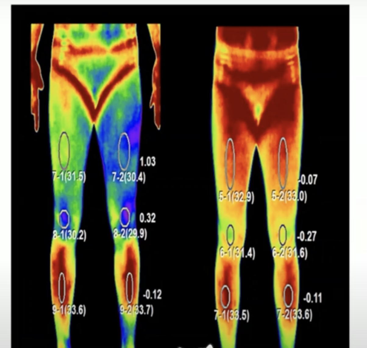 40대 이후 꼭 알아야 할 혈액순환의 핵심 원리(NO)