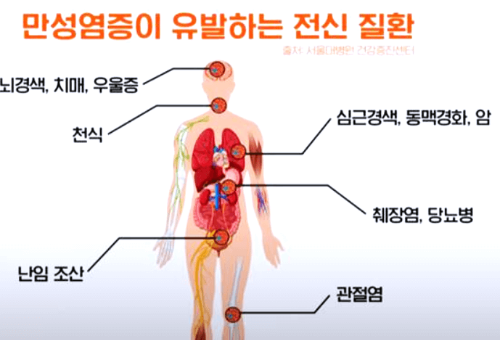 만성염증-전신질환