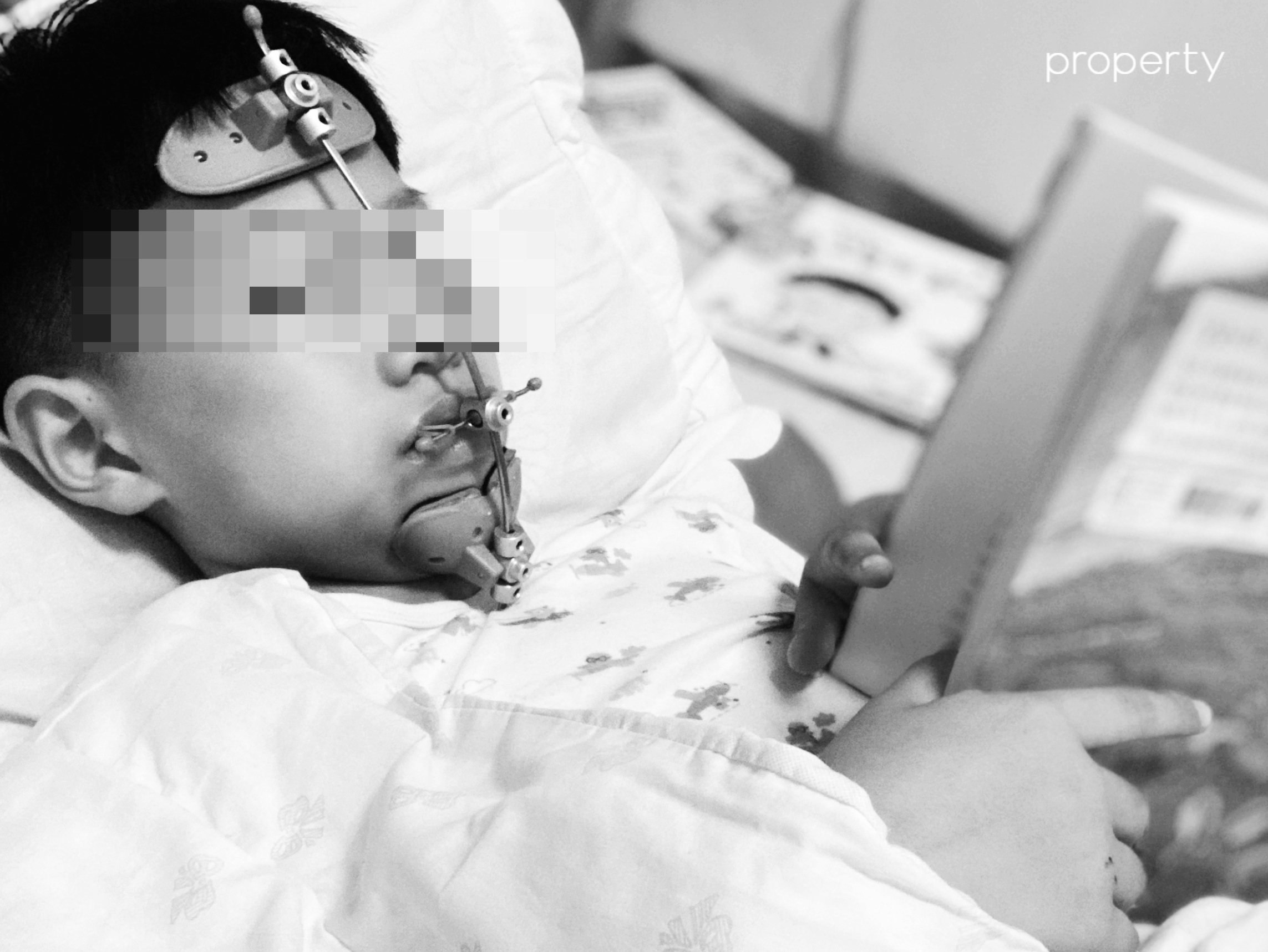 턱교정장치-페이스마스크낀채로-이불위에누워서-책보다가-잠든아이