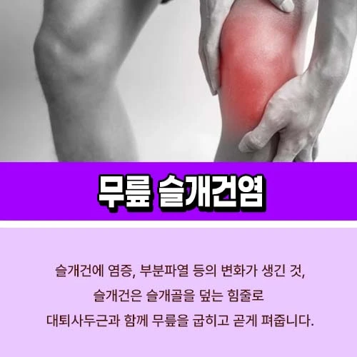무릎 슬개건염