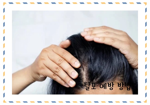 탈모 예방 방법 알아보고 예방