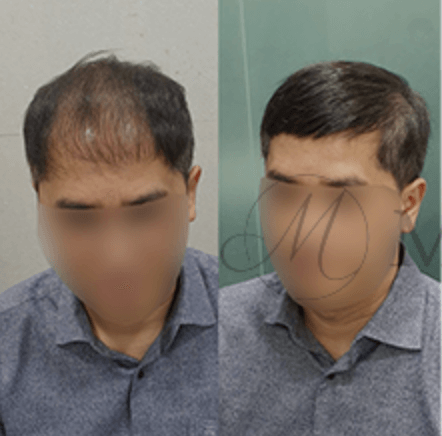 가발의여왕(메이모)