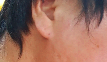 귀를-확대한-모습