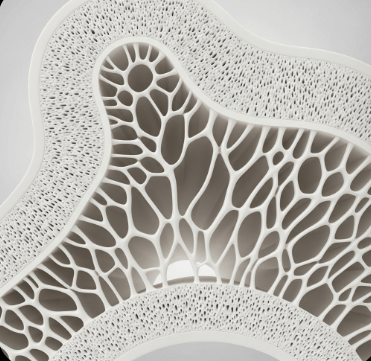 골밀도 검사 비용과 방법 안내2