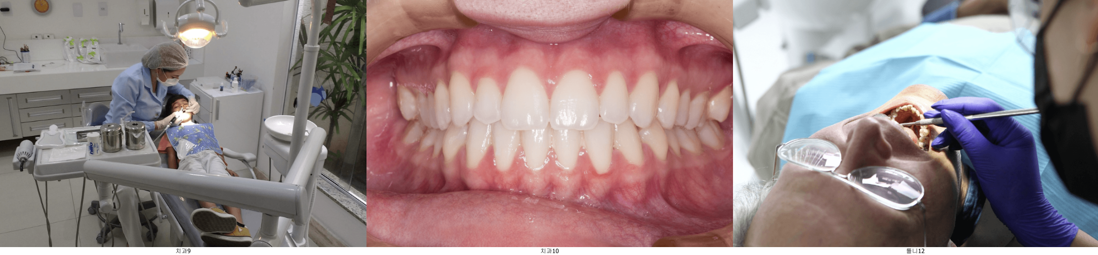 치과 치료