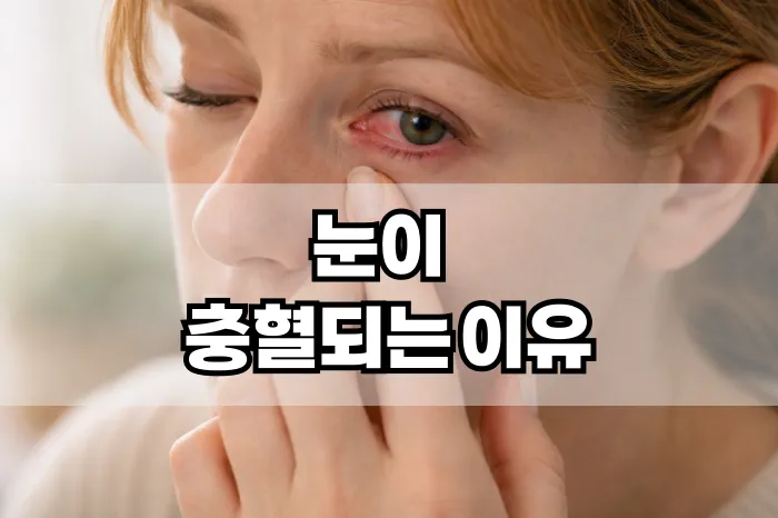 눈이 충혈되는 이유