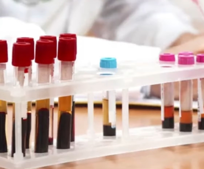 에이즈 초기증상