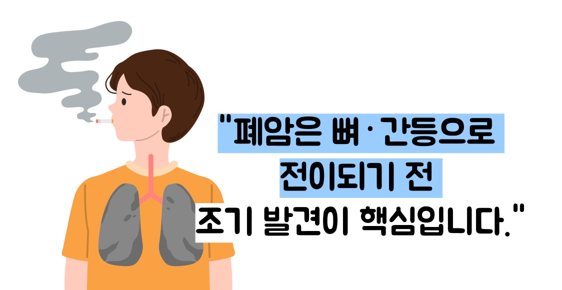 폐암 초기증상