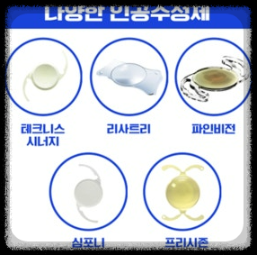 백내장 인공수정체 결정 완벽 가이드