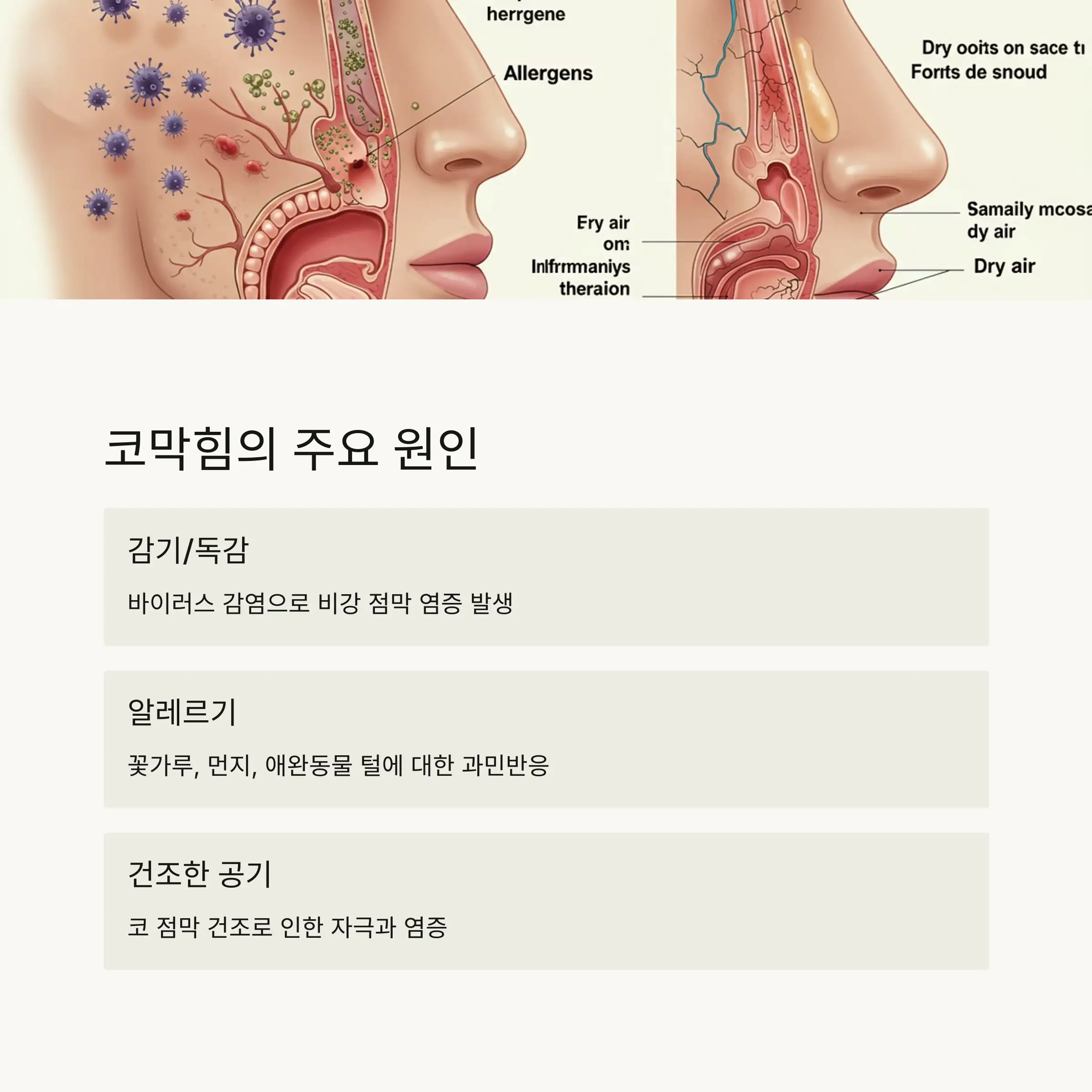 🔍 코막힘의 주요 원인