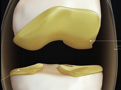 콘드로이친 1200mg 효능&amp;#44; 부작용&amp;#44; 복용법
