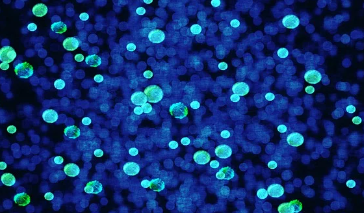 엠폭스-백신-관련주