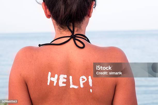 썬텐 피부 관련 사진