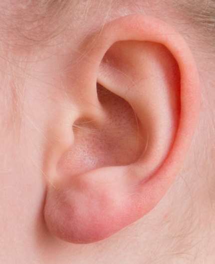 귀는 스스로 청소한다? 귓밥의 진짜 역할과 귀 건강을 지키는 방법