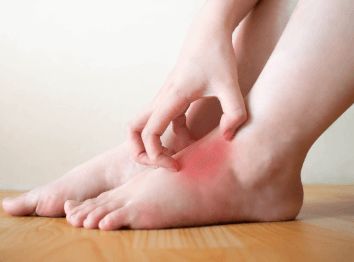 발등이 부어오르는 이유