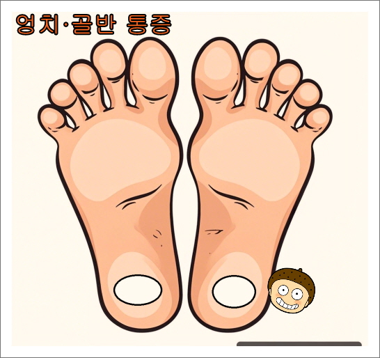 발바닥 파스 붙이는 위치_엉덩이 골반 통증