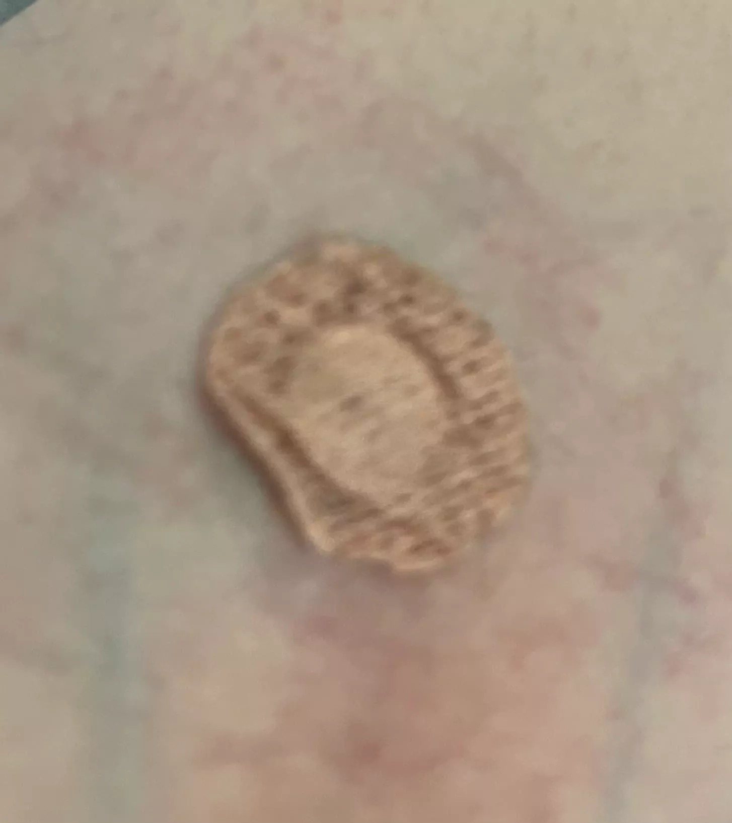 사진1-혈액검사-부위