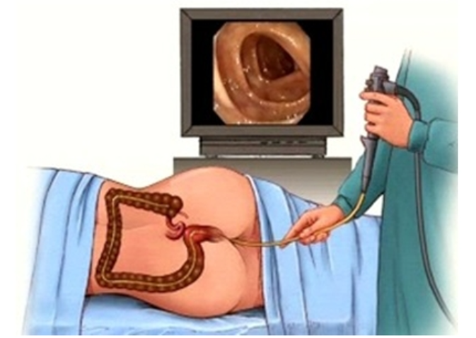 위&middot;대장 내시경