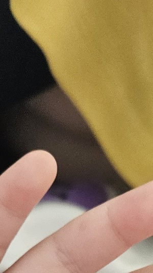 수족구병 증상 격리기간