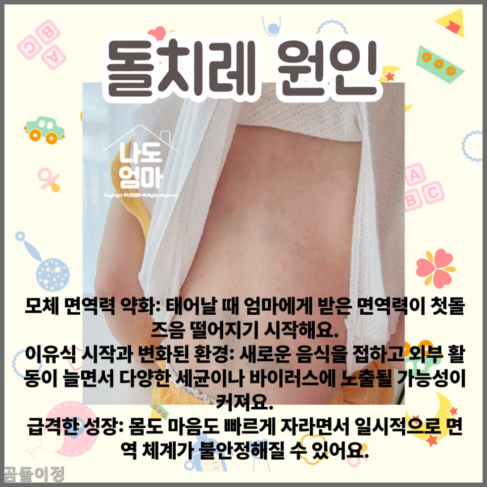 열꽃 두드러기 원인과 치료 방법, 아기 얼굴 관리 꿀팁