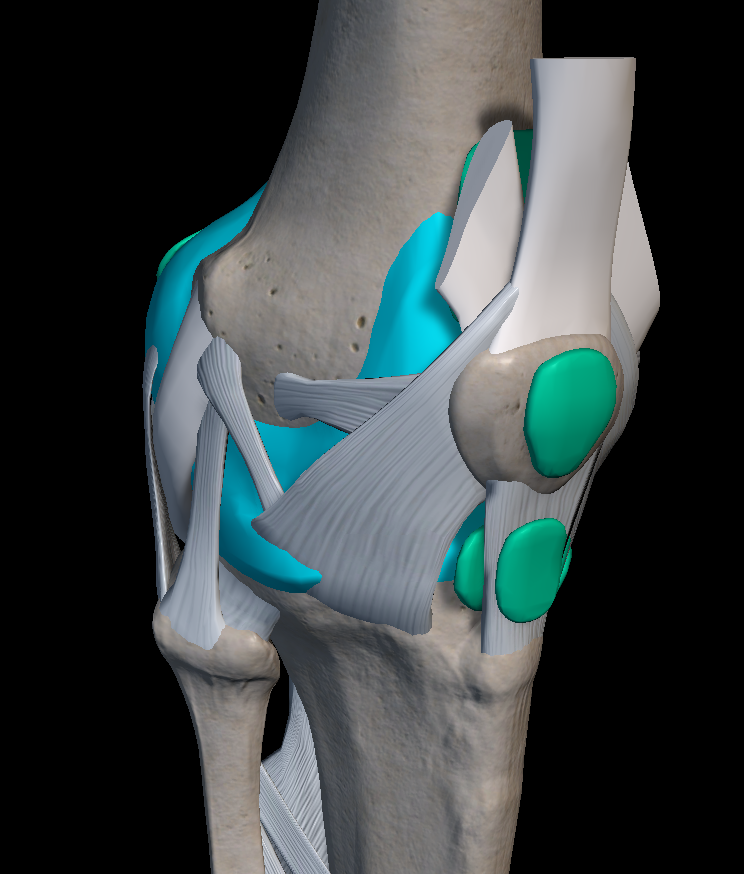 무릎 인대 파열 원인