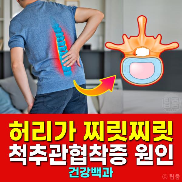 허리가 찌릿 아플때 척추관협착증 증상 원인