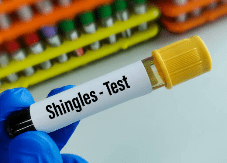 대상포진 예방접종 가격