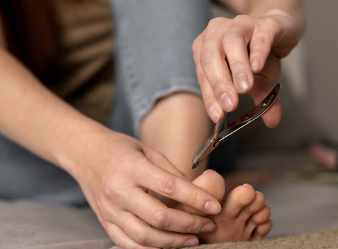 티눈 없애는 방법