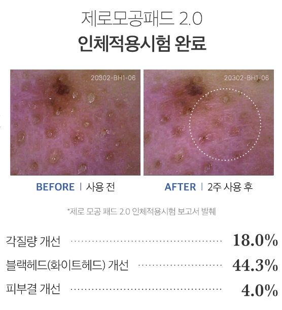 메디큐브 모공패드