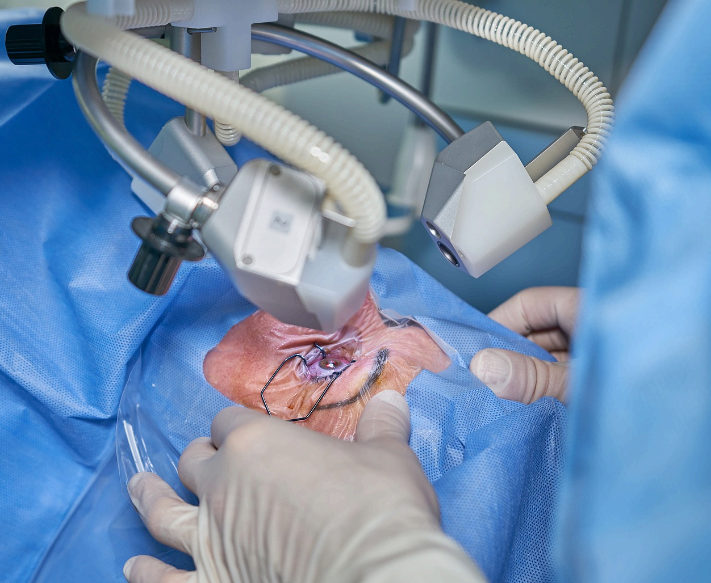 백내장 수술비용 사진