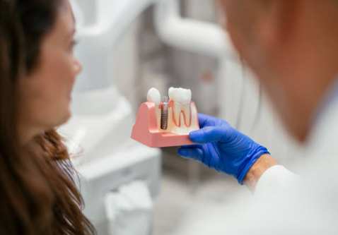 임플란트 뼈이식