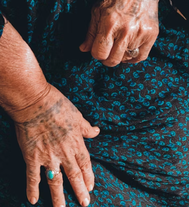 콘드로이친 효능 복용법 시간 부작용